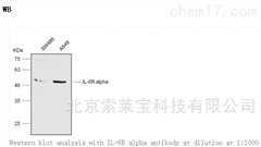 K106877PAnti-IL-6R alpha Polyclonal Antibody