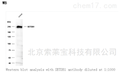 K000422PAnti-SETDB1 Polyclonal Antibody
