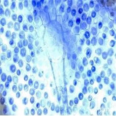Aurora A抑制劑